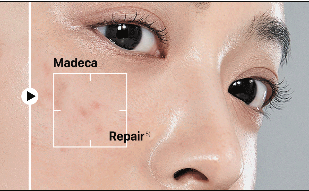 Centellian 24 Madeca Cream Time Reverse Metamon Edition 50ml x 2 + Metamon Keyring Pouch