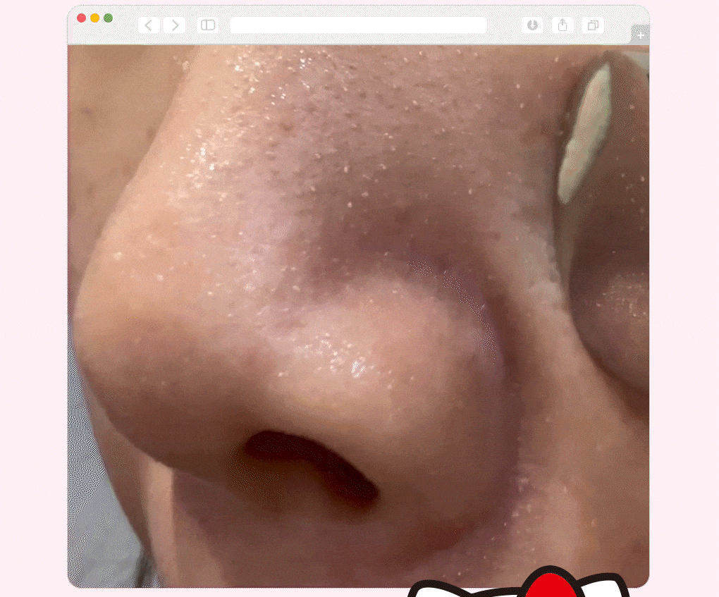 [Hello Kitty X Ilso Super Melting Sebum Softener 150ML Plan (+Hello Kitty Blackhead Remover + 40 Sticky Cotton Pads)