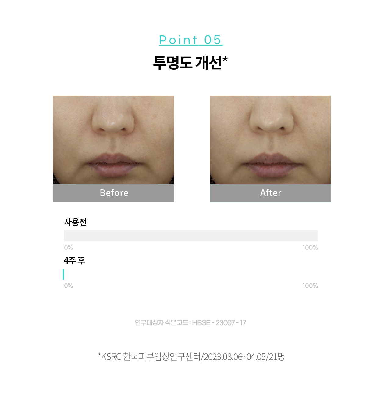[PDRN Freckle Cream/New Photoaging Care] Rejuran Biome Healer Youth Formula Cream 50ml