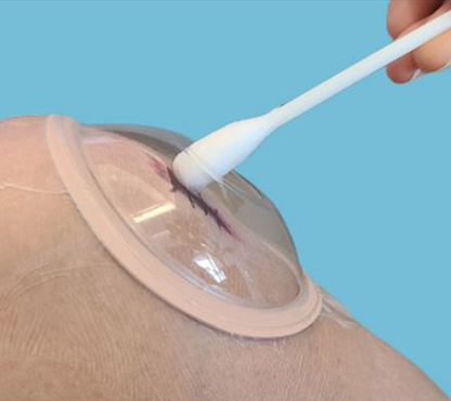 Andazzi -  Wound Protection Cap