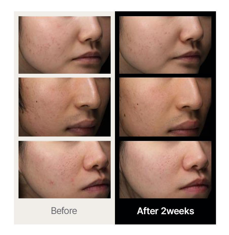 Kiiikiii Jiyu X Dr. Althea 345 Relief Cream 50ml  [Olive Young Global No. 1 Cream]