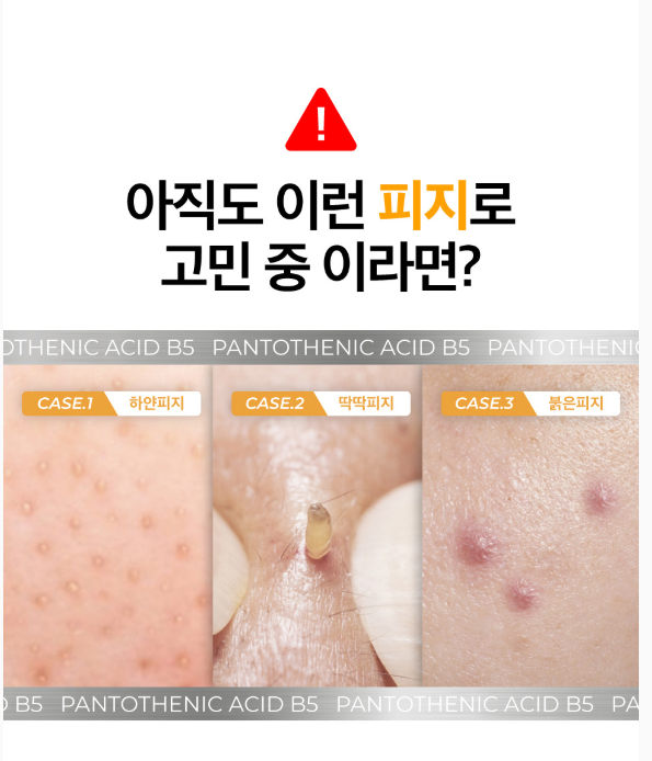 [NCT WISH Pick] NUMBUZIN Pantothenic B5 Active Soothing Cream