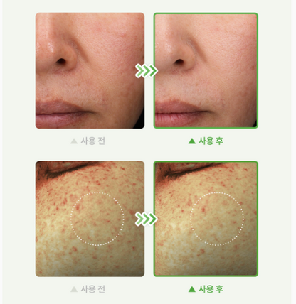 Dr. Althea Gentle Vitamin C Serum