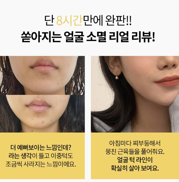 Milk Touch Slim Face Ceramic Braces