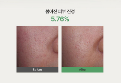 [Ive Won-young Pick] Dr. Althea Stretch Fit Calming Pads 50 Sheets