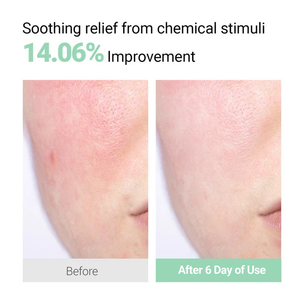 [BTS Jhope Pick] Neaf Neaf Soothing Calm Cream 50g