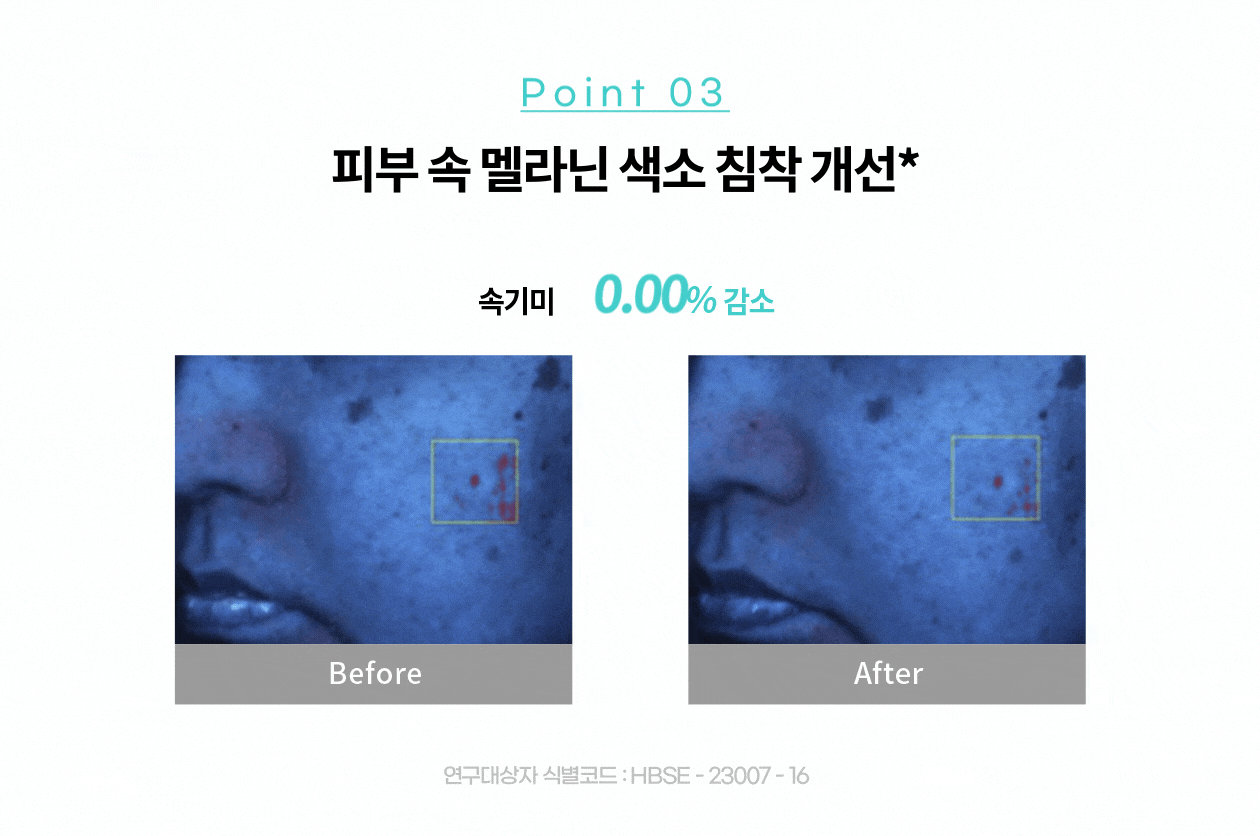 [PDRN Freckle Cream/New Photoaging Care] Rejuran Biome Healer Youth Formula Cream 50ml