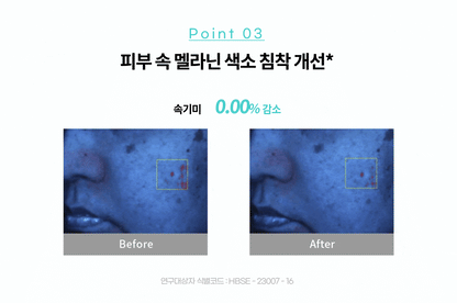 [PDRN Freckle Cream/New Photoaging Care] Rejuran Biome Healer Youth Formula Cream 50ml