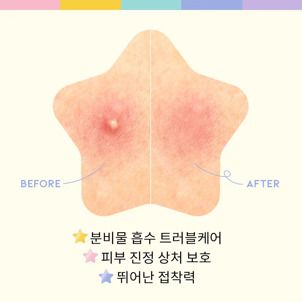 OOTD Twinkle Little Star Spot Patch