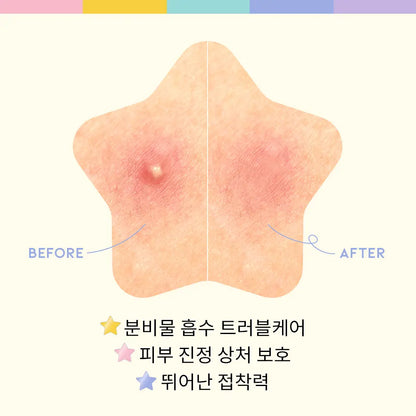 OOTD Twinkle Little Star Spot Patch
