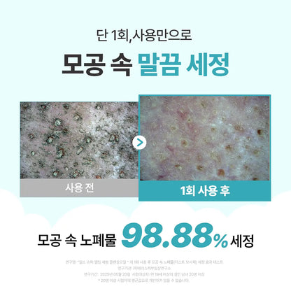 Manggomi X Ilso Super Melting Sebum Cleansing Oil 200ml with Gift (+ Scrunchie)