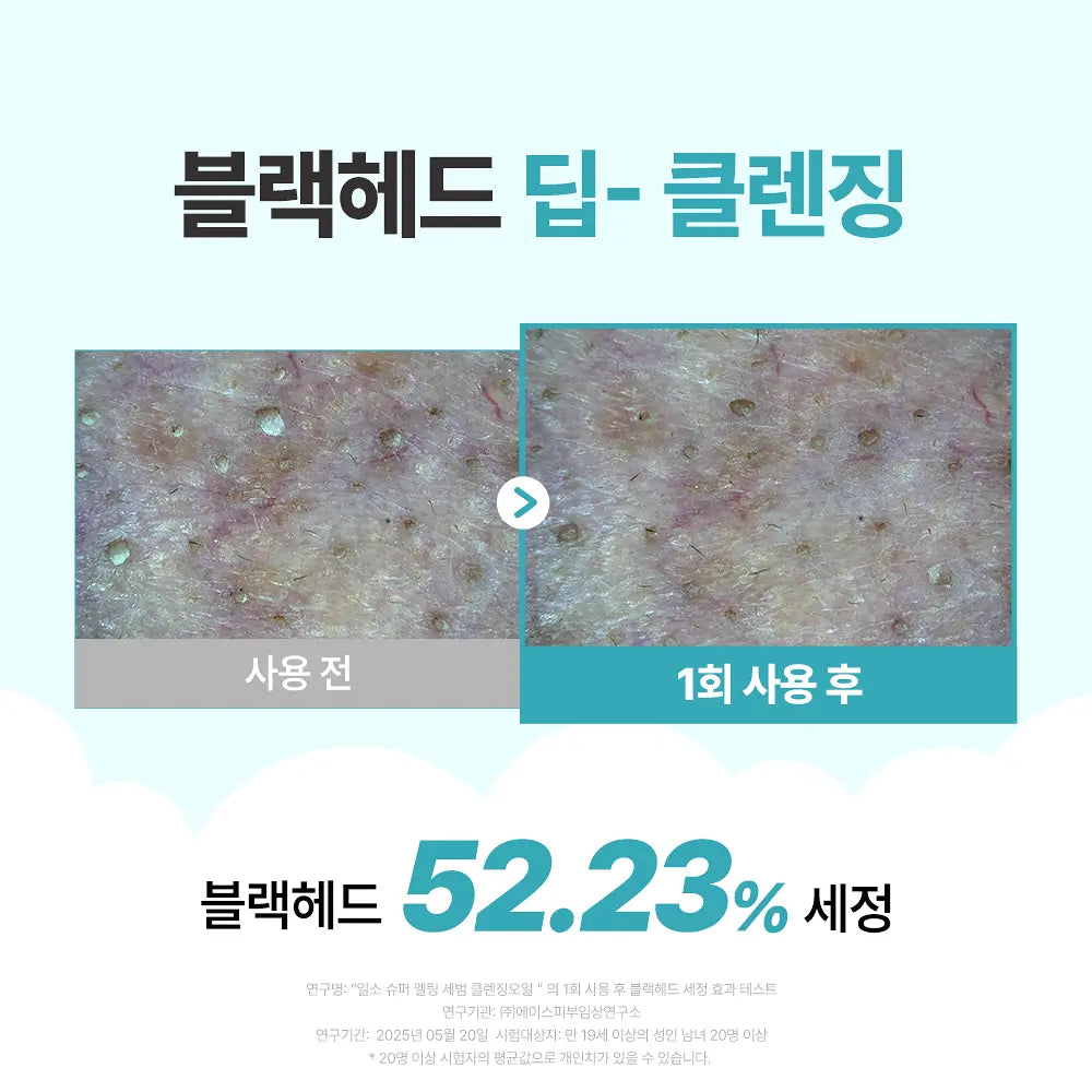 Manggomi X Ilso Super Melting Sebum Cleansing Oil 200ml with Gift (+ Scrunchie)
