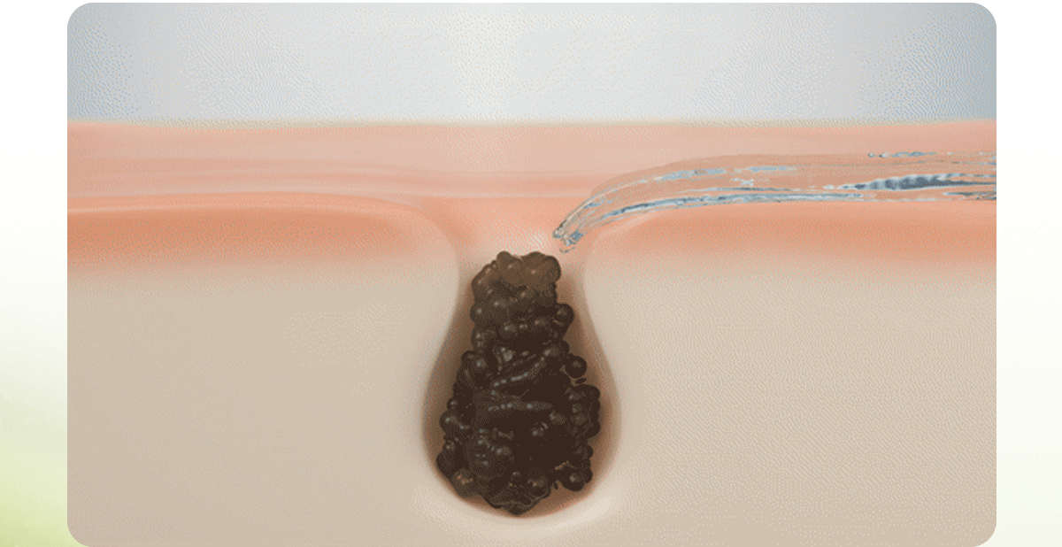 Centellian 24 Madeca Matcha Toning Peeling Gel 150ml