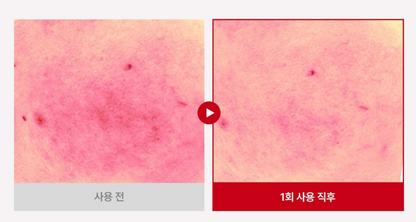 RDRD - Soothing Toner & Soothing Serum