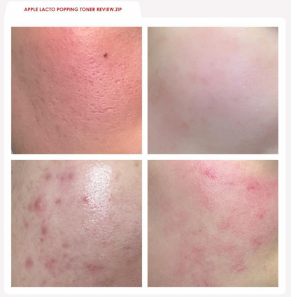 RDRD - Soothing Toner & Soothing Serum