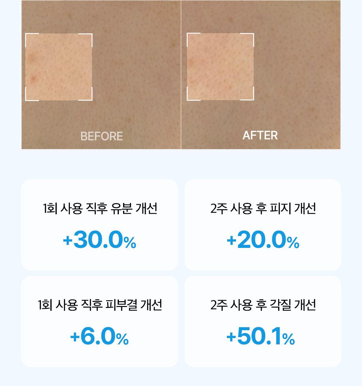 Forment Acne Perfume Shower Cotton Hug 500ml Crayon Shin-chan Edition (+ Crayon Shin-chan Bath Glove)