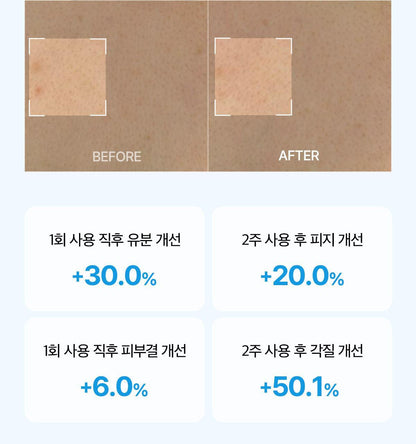 Forment Acne Perfume Shower Cotton Hug 500ml Crayon Shin-chan Edition (+ Crayon Shin-chan Bath Glove)