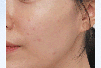 [White Holiday] Babymonster X Banila Co White/Moisture Cushion